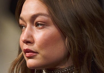 Por qué el cuero cabelludo también puede picar en invierno